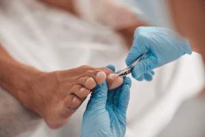 Man getting overgrown toe nails clipped during pedicure