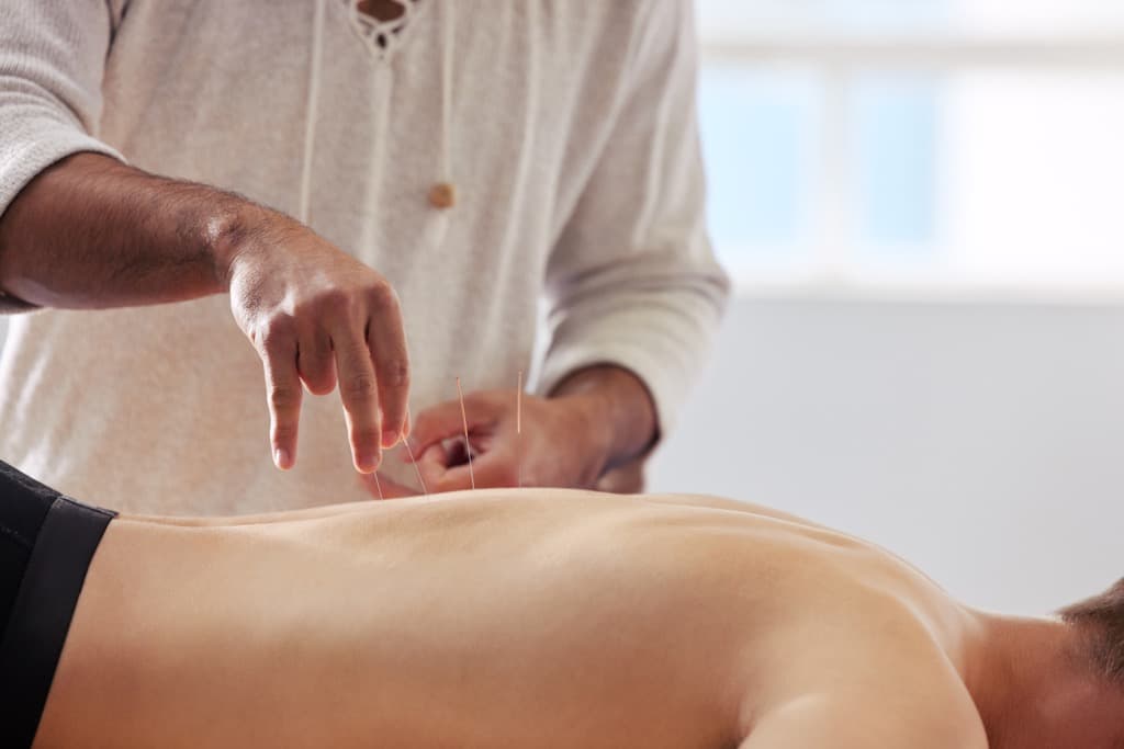 Your Acupuncture Business Plan (with Sample Template!)