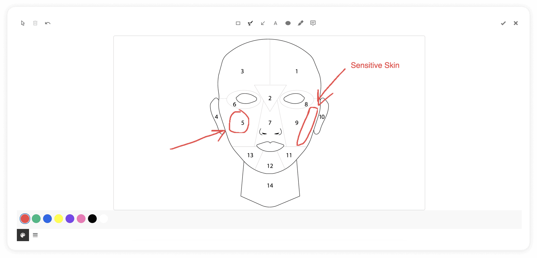Draw & Annotate on SOAP Notes
